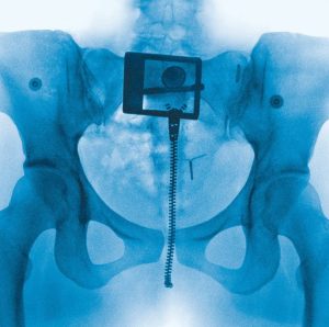 Imagem: reprodução/Instagram @lorde